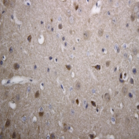 Synuclein beta Antibody in Immunohistochemistry (Paraffin) (IHC (P))