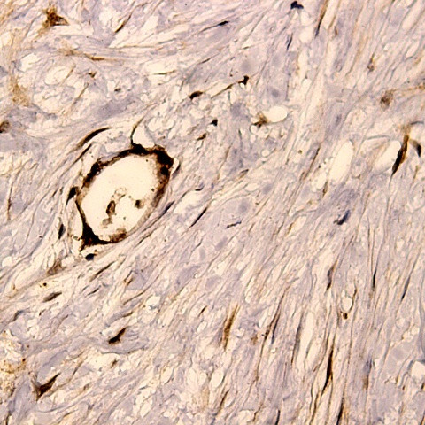 GluR4 Antibody in Immunohistochemistry (Paraffin) (IHC (P))