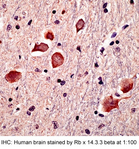 14-3-3 beta Antibody in Immunohistochemistry (Paraffin) (IHC (P))