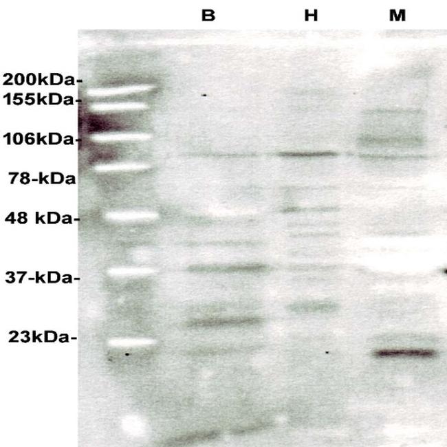 hGH Antibody in Western Blot (WB)