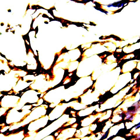 Catenin alpha Antibody in Immunohistochemistry (Paraffin) (IHC (P))