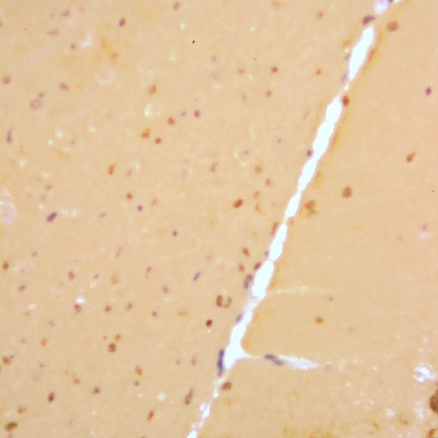 Presenilin Antibody in Immunohistochemistry (Paraffin) (IHC (P))