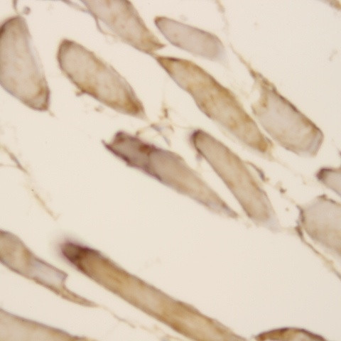 TGF-beta 2 Antibody in Immunohistochemistry (Paraffin) (IHC (P))