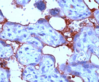 TGF-beta 2 Antibody in Immunohistochemistry (Paraffin) (IHC (P))