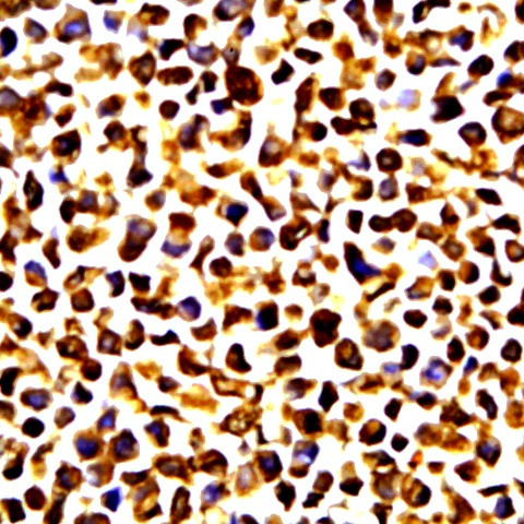 MMP-14 Antibody in Immunocytochemistry (ICC/IF)