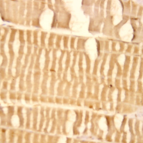 TGF beta Antibody in Immunohistochemistry (Paraffin) (IHC (P))