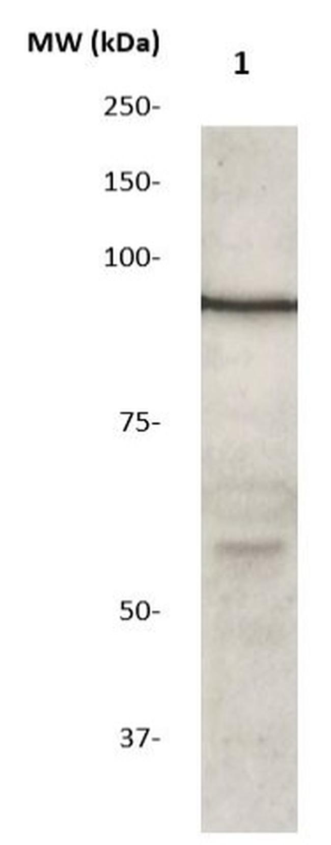 STAT6 Antibody in Western Blot (WB)