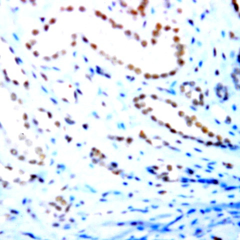 Estrogen Receptor beta (ER beta) Antibody in Immunohistochemistry (Paraffin) (IHC (P))