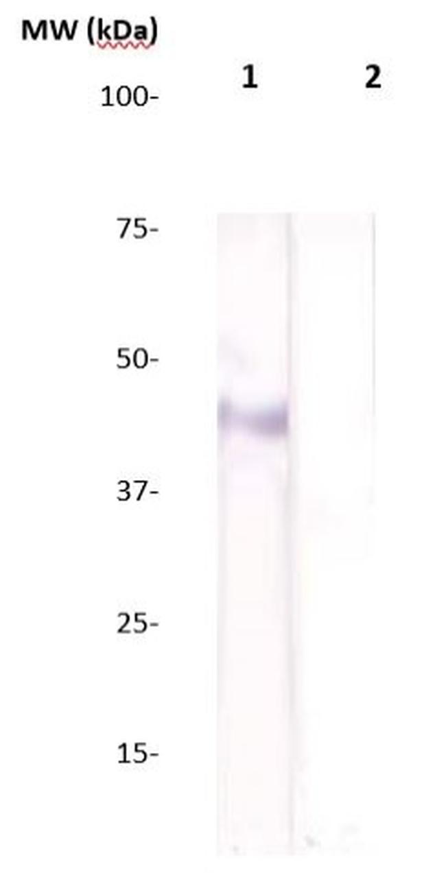 Estrogen Receptor beta (ER beta) Antibody in Western Blot (WB)