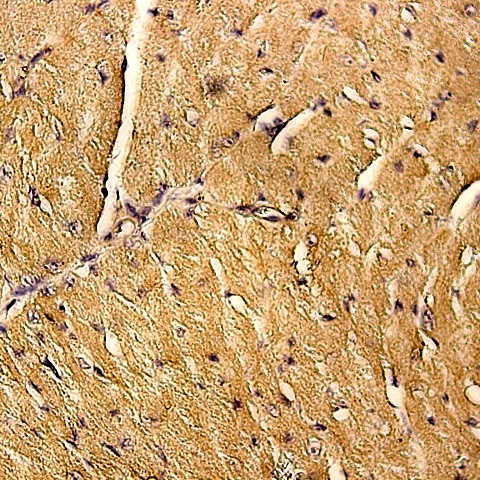 Actin, Muscle Specific Antibody in Immunohistochemistry (Paraffin) (IHC (P))