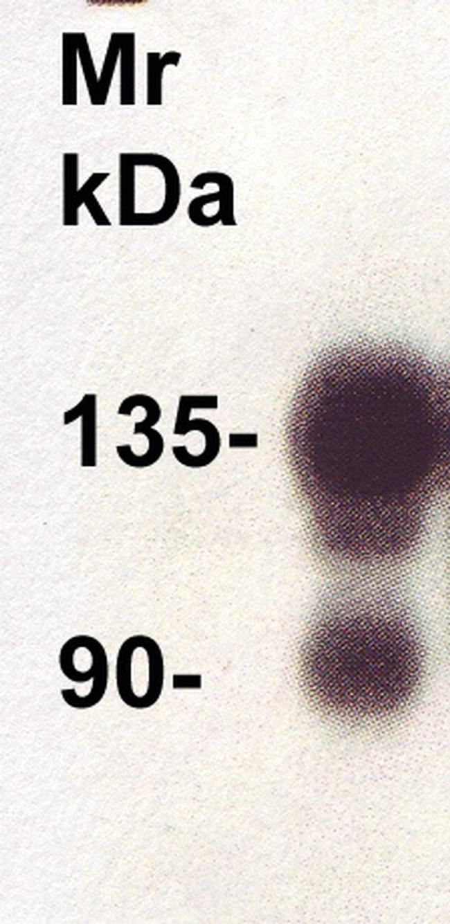 Insulin Receptor (IR) Antibody in Western Blot (WB)