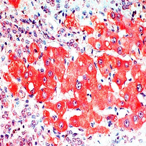 Alpha Fetoprotein (AFP) Antibody in Immunohistochemistry (Paraffin) (IHC (P))