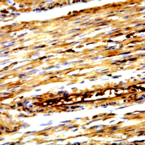 c-erbB-4/HER-4 Antibody in Immunohistochemistry (Paraffin) (IHC (P))