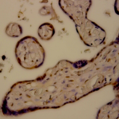 Caspase 6 Antibody in Immunohistochemistry (Paraffin) (IHC (P))