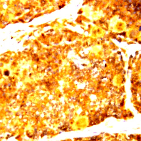 IRAK Antibody in Immunohistochemistry (Paraffin) (IHC (P))