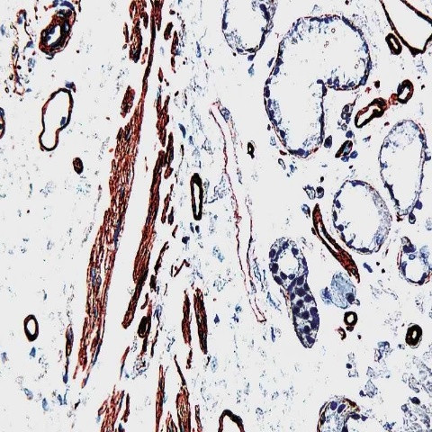 Laminin Antibody in Immunohistochemistry (Paraffin) (IHC (P))