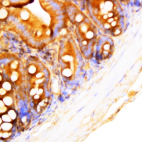 Mekk-1 Antibody in Immunohistochemistry (Paraffin) (IHC (P))