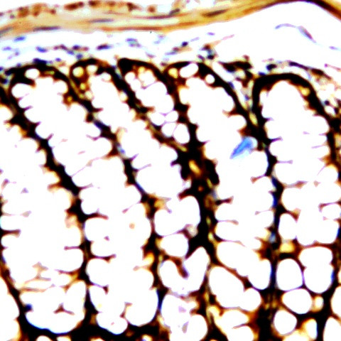 Ras Antibody in Immunohistochemistry (Paraffin) (IHC (P))