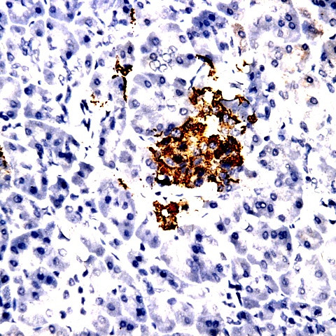 ADAM10/KUZ Antibody in Immunohistochemistry (Paraffin) (IHC (P))