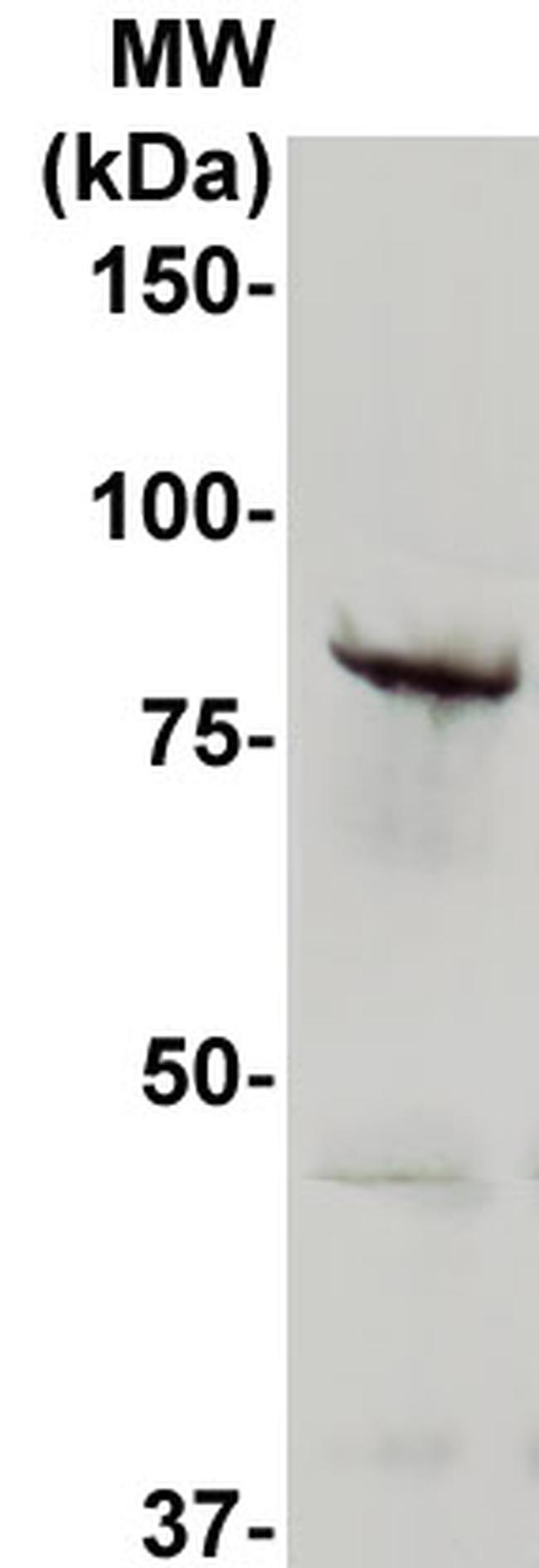 ADAM10/KUZ Antibody in Western Blot (WB)