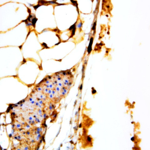 Caspase 13 Antibody in Immunohistochemistry (Paraffin) (IHC (P))