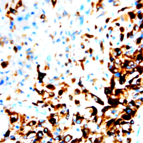 CCR8 Antibody in Immunohistochemistry (Paraffin) (IHC (P))