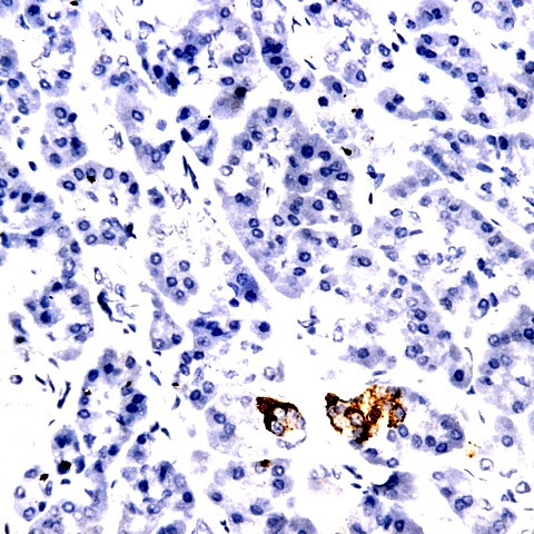 Eotaxin Antibody in Immunohistochemistry (Paraffin) (IHC (P))