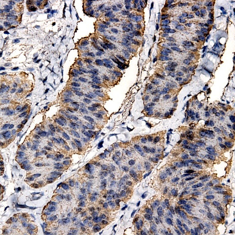 MMP-8 Antibody in Immunohistochemistry (Paraffin) (IHC (P))