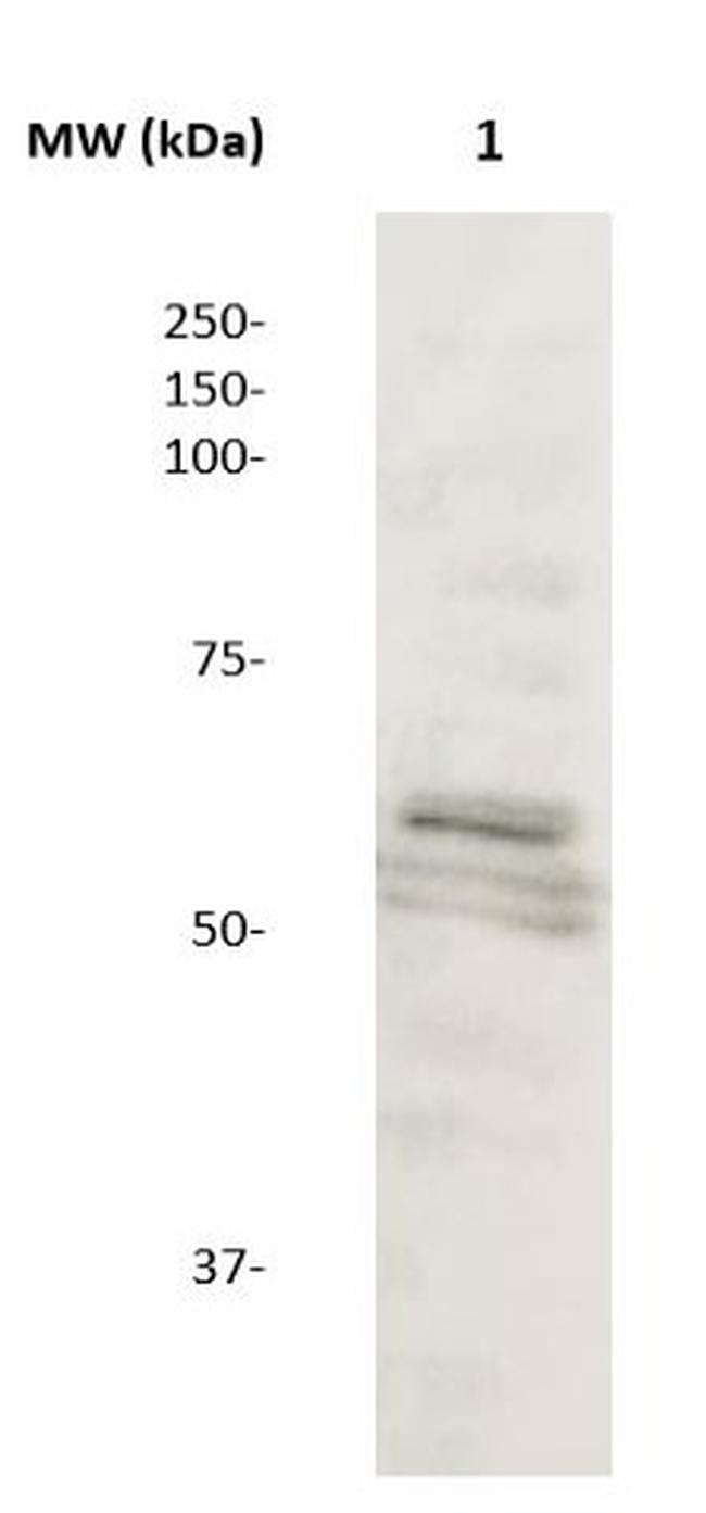 MMP-8 Antibody in Western Blot (WB)