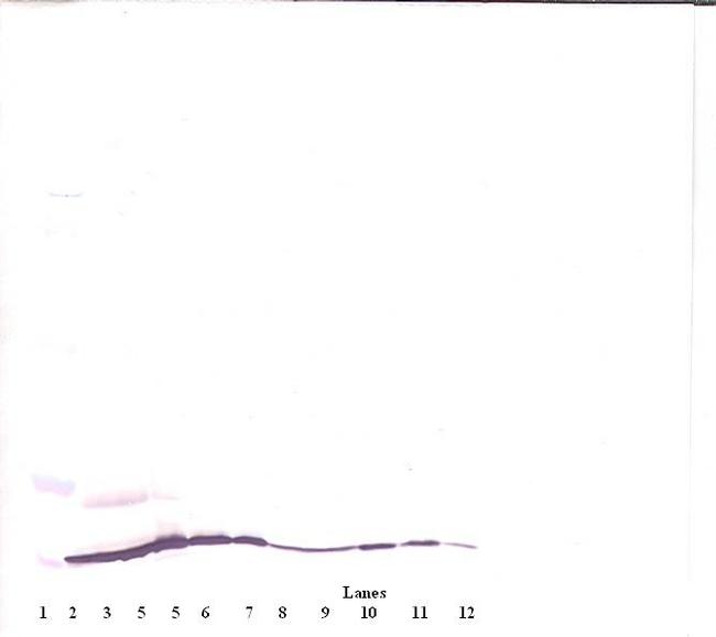 Eotaxin Antibody in Western Blot (WB)