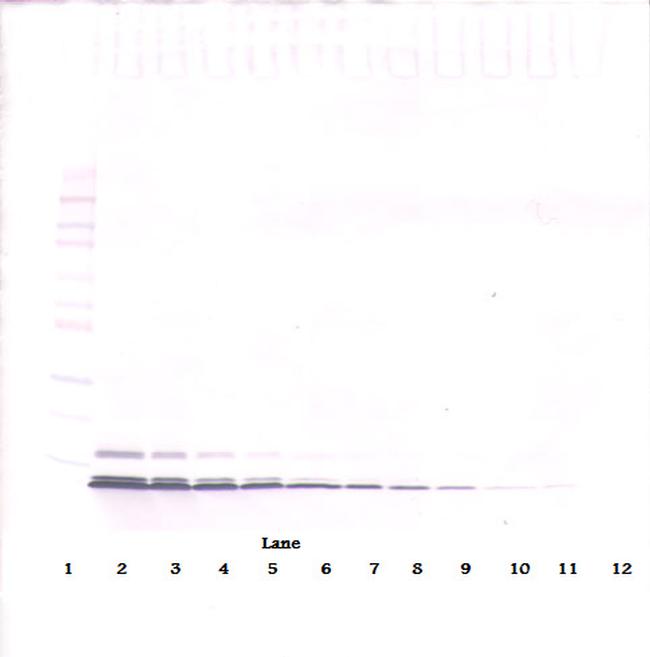 CCL5 (RANTES) Antibody in Western Blot (WB)