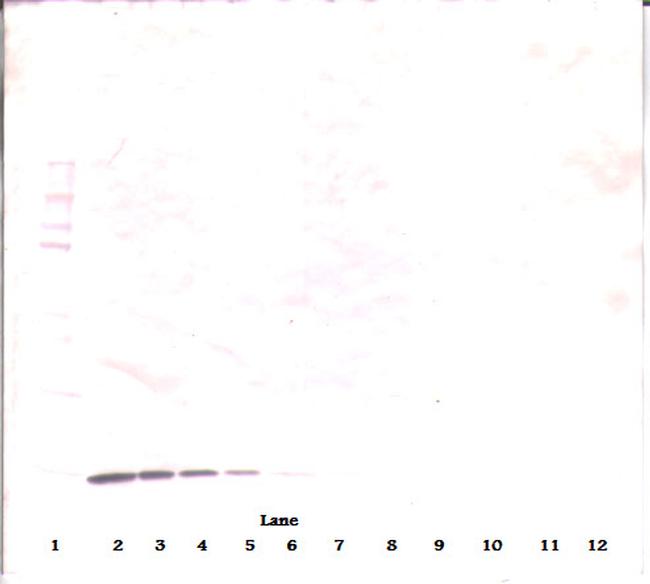 beta-NGF Antibody in Western Blot (WB)