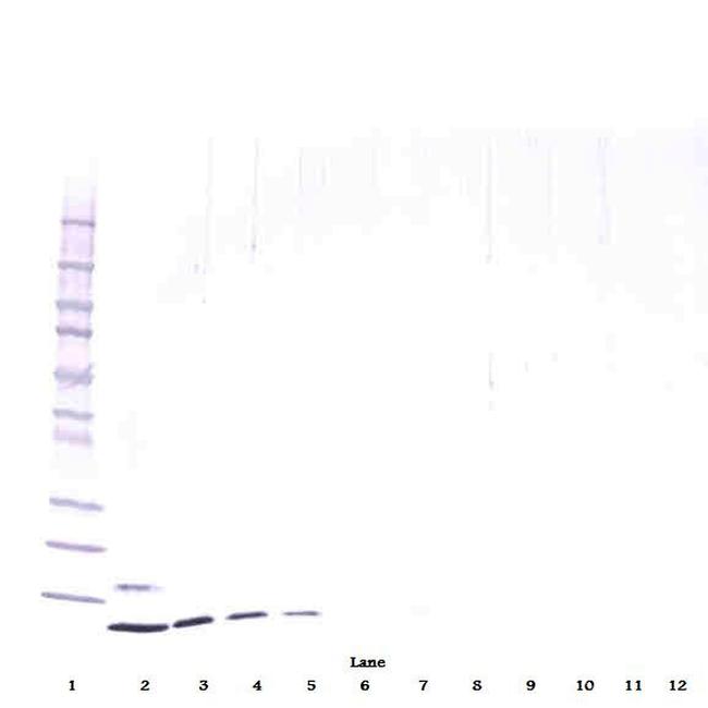 Resistin Antibody in Western Blot (WB)