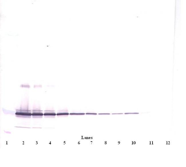 IL-11 Antibody in Western Blot (WB)