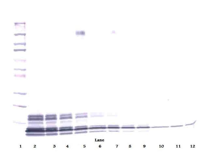 PPBP Antibody in Western Blot (WB)