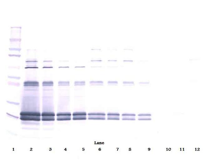 Cardiotrophin 1 Antibody in Western Blot (WB)