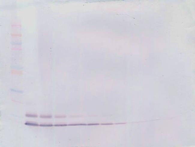 CCL5 (RANTES) Antibody in Western Blot (WB)