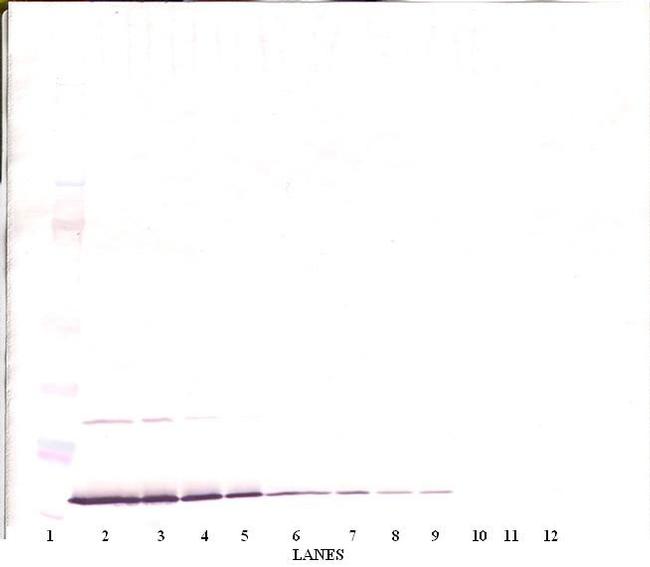 IFN gamma Antibody in Western Blot (WB)