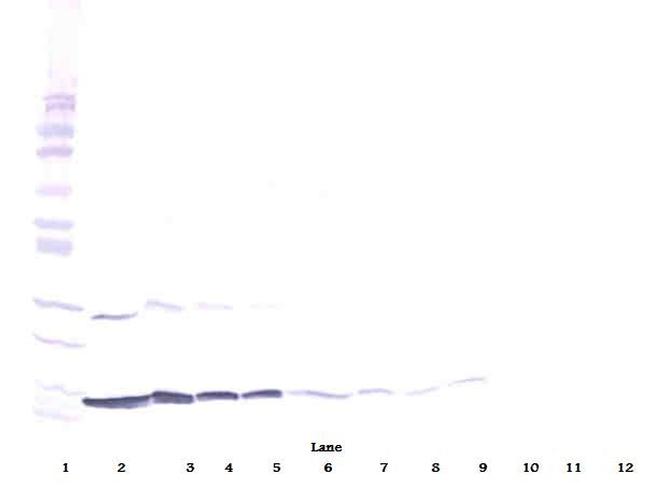 IFN gamma Antibody in Western Blot (WB)