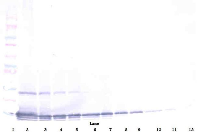 TECK Antibody in Western Blot (WB)