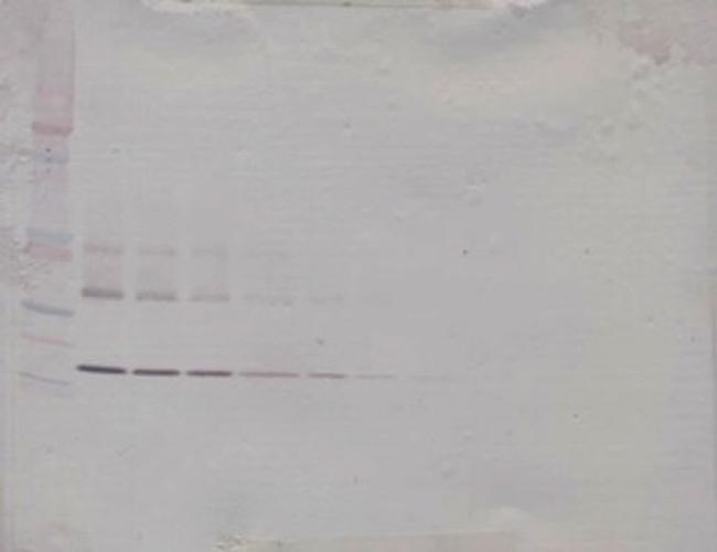 RANK (soluble) Antibody in Western Blot (WB)