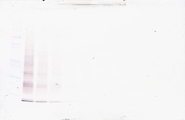 IL-15 Antibody in Western Blot (WB)