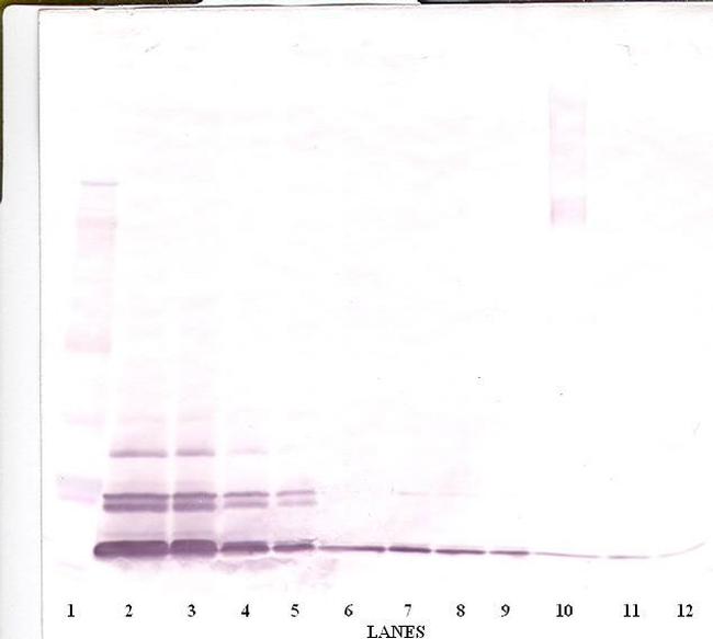 Eotaxin 3 Antibody in Western Blot (WB)