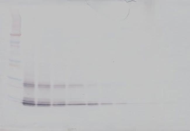 IL-15 Antibody in Western Blot (WB)