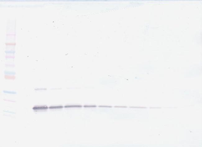 TNFR2 (soluble) Antibody in Western Blot (WB)