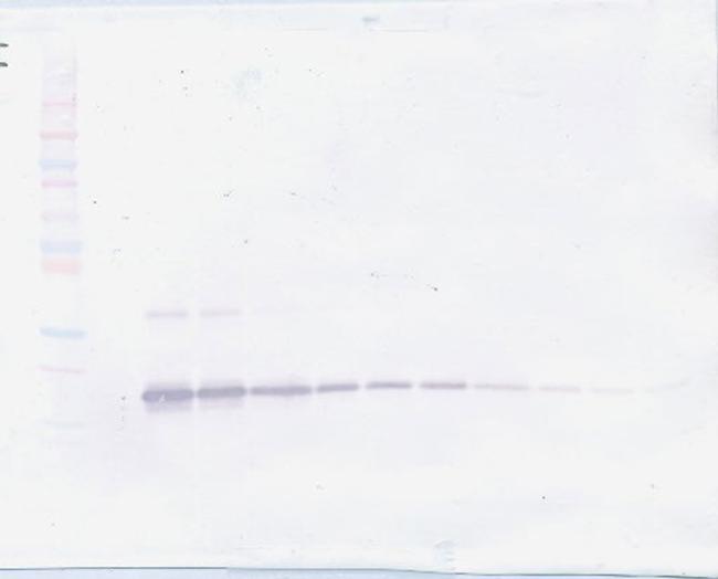 TNFR2 (soluble) Antibody in Western Blot (WB)