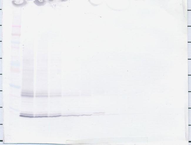 IL-15 Antibody in Western Blot (WB)