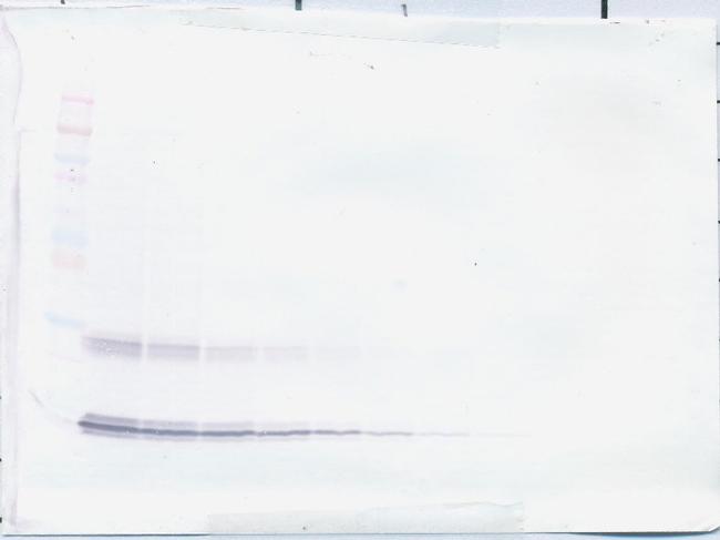 IL-15 Antibody in Western Blot (WB)