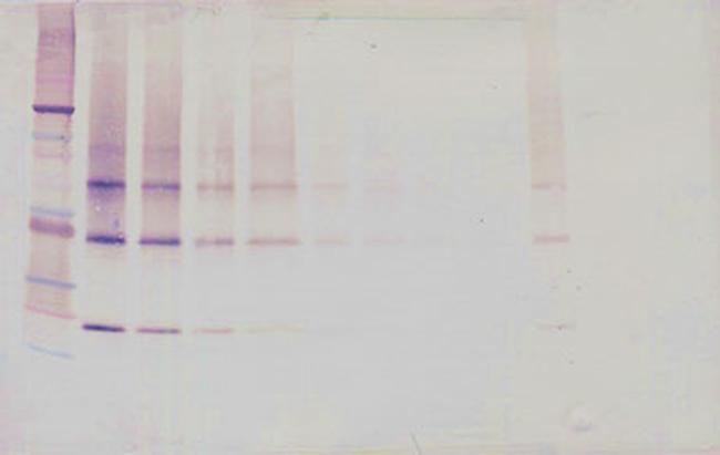 Adipolean variant Antibody in Western Blot (WB)