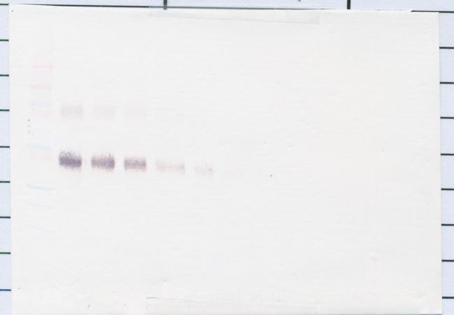 CD25 (soluble) Antibody in Western Blot (WB)